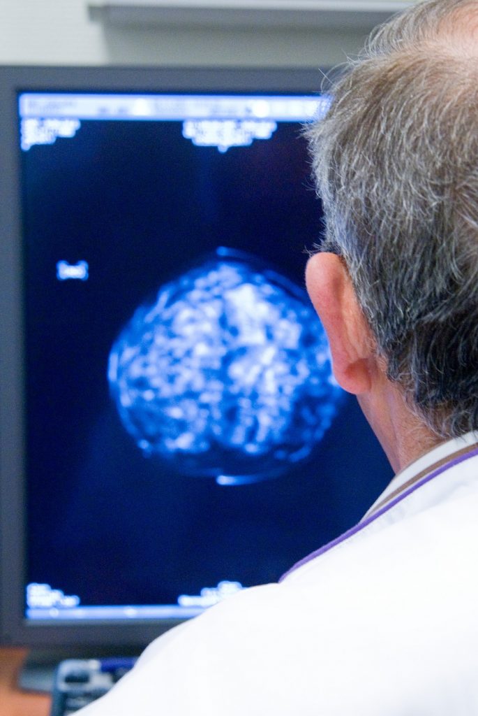 Snelle diagnose borstkanker