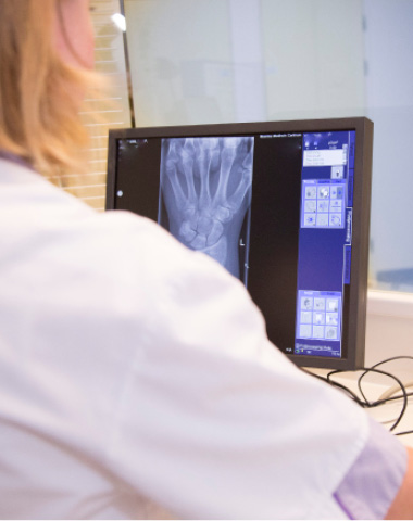 Zorgprofessional bekijkt röntgenbeeld van hand