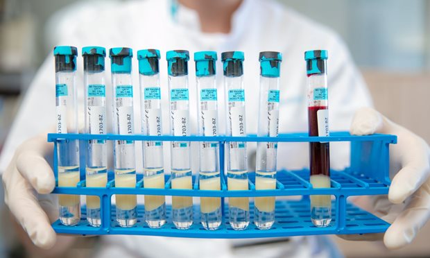 Plaatje Microbiologie buizen